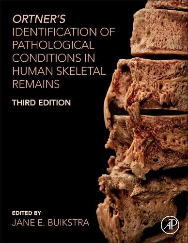 Ortner�s Identification of Pathological Conditions in Human Skeletal Remains