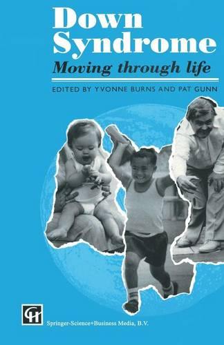Down Syndrome: Moving through life