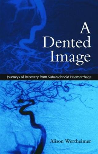 A Dented Image: Journeys of Recovery from Subarachnoid Haemorrhage