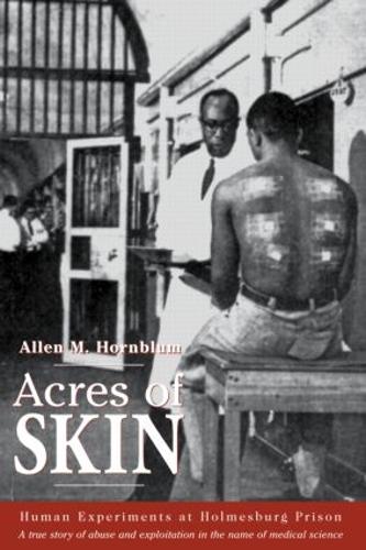 Acres of Skin: Human Experiments at Holmesburg Prison