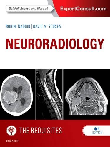 Neuroradiology: The Requisites, 4e (Requisites in Radiology)
