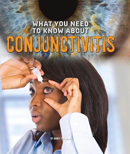 What You Need to Know About Conjunctivitis (Fact Finders: Focus on Health)