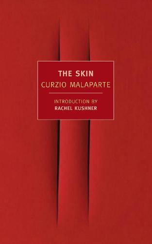 The Skin (New York Review Books Classics)
