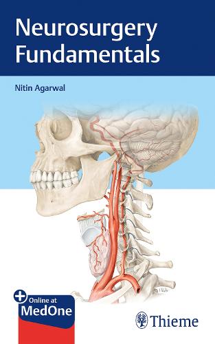 Neurosurgery Fundamentals