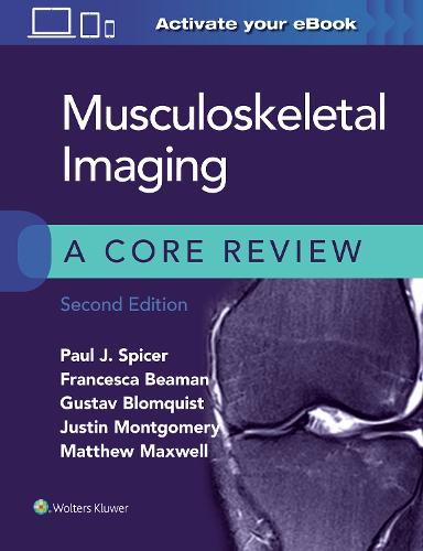 Musculoskeletal Imaging: A Core Review