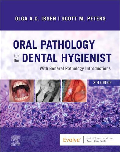 Oral Pathology for the Dental Hygienist: With General Pathology Introductions