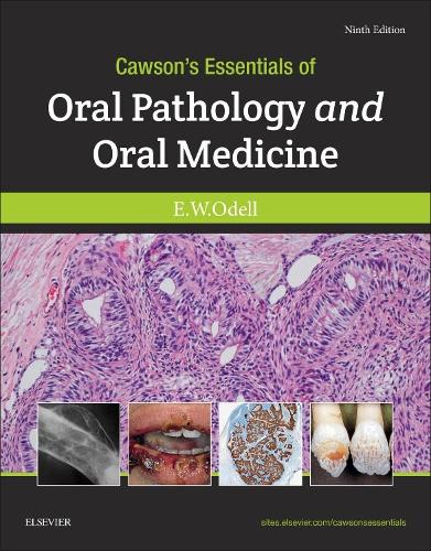 Cawson's Essentials of Oral Pathology and Oral Medicine, 9e