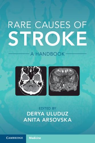 Rare Causes of Stroke: A Handbook
