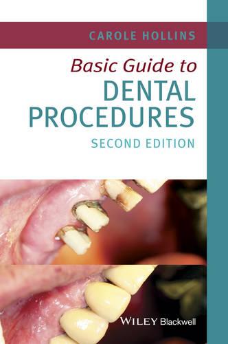 Basic Guide to Dental Procedures (Basic Guide Dentistry Series)