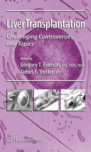 Liver Transplantation: Challenging Controversies and Topics (Clinical Gastroenterology)