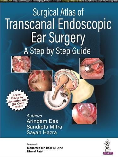 Surgical Atlas of Transcanal Endoscopic Ear Surgery: A Step by Step Guide